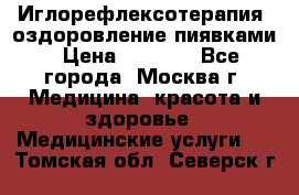 Иглорефлексотерапия, оздоровление пиявками › Цена ­ 3 000 - Все города, Москва г. Медицина, красота и здоровье » Медицинские услуги   . Томская обл.,Северск г.